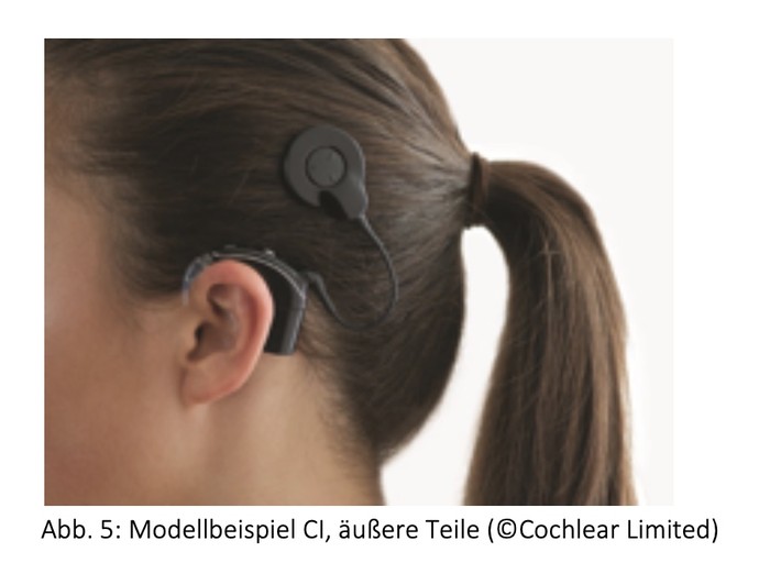 Modellbeispiel CI Äußere Teile