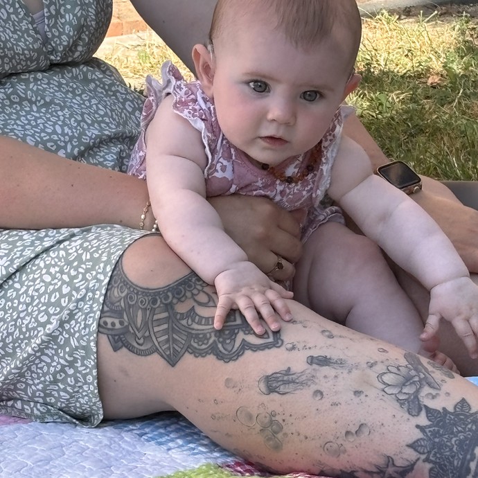 None (vergrößerte Bildansicht wird geöffnet)